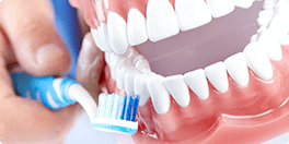 予防的歯科処置