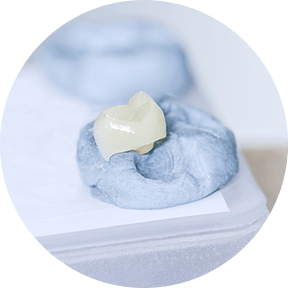 審美的歯科治療